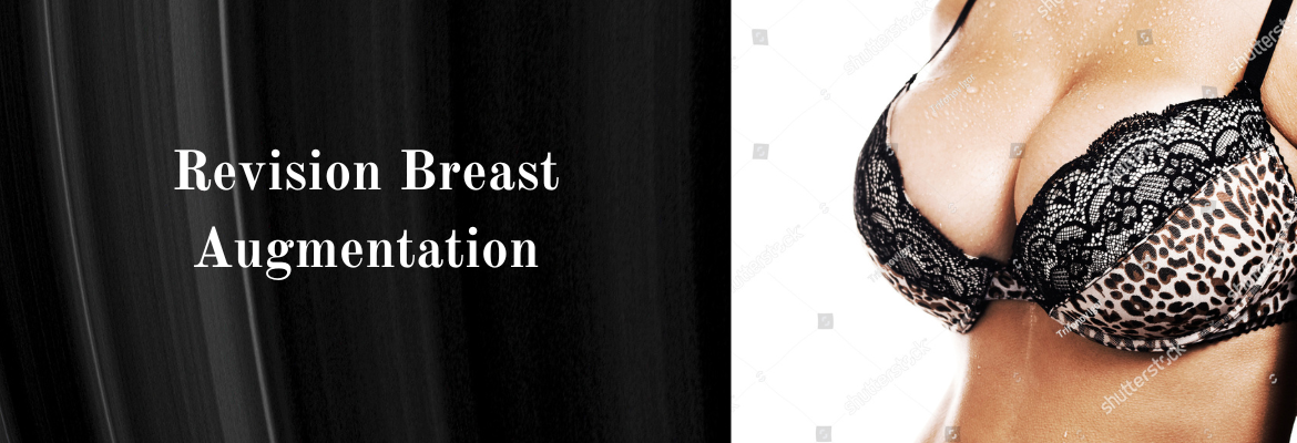 Breast Augmentation